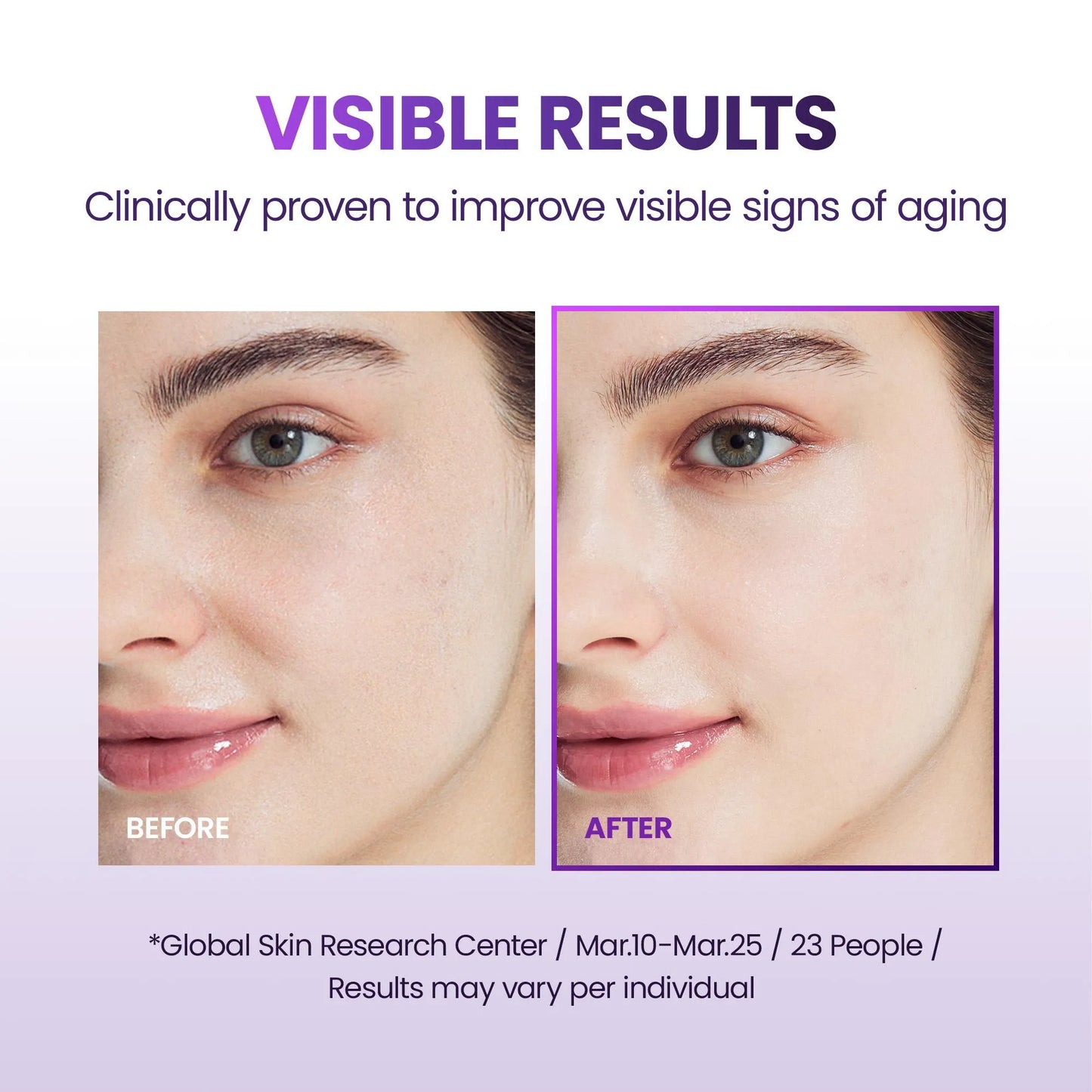 BIOHEAL BOH Probioderm 3D Lifting Cream Mask Before and after comparison of facial skin with text about visible results and clinical provenance