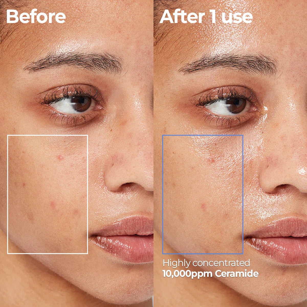AESTURA Atobarrier 365 Cream Mist Before and after comparison of a facial product's effect on skin with visible improvements after 1 use
