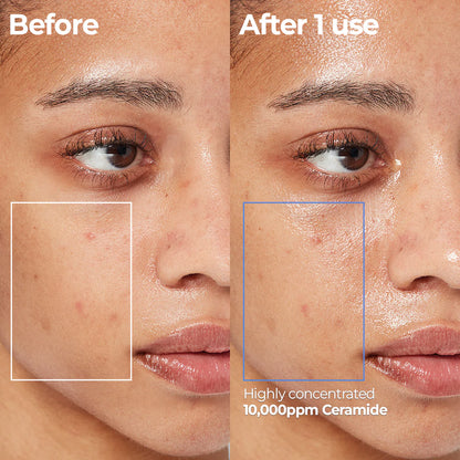 AESTURA Atobarrier 365 Cream Mist Before and after comparison of a facial product's effect on skin with visible improvements after 1 use