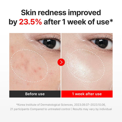 Centellian24 Madeca Cream Time Reverse  Before and after comparison of skin redness improvement with text indicating 23.5% reduction after one week of use.