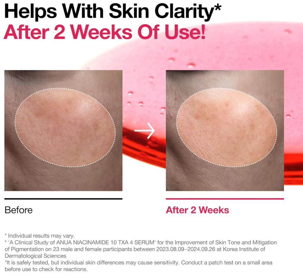 Anua Niacinamide 10% + TXA 4% Serum for Brightening and Dark Spots Before and after comparison of skin clarity with text indicating improvement after 2 weeks of use.