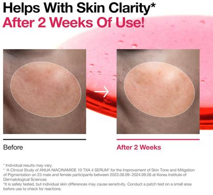 Anua Niacinamide 10% + TXA 4% Serum for Brightening and Dark Spots Before and after comparison of skin clarity with text indicating improvement after 2 weeks of use.