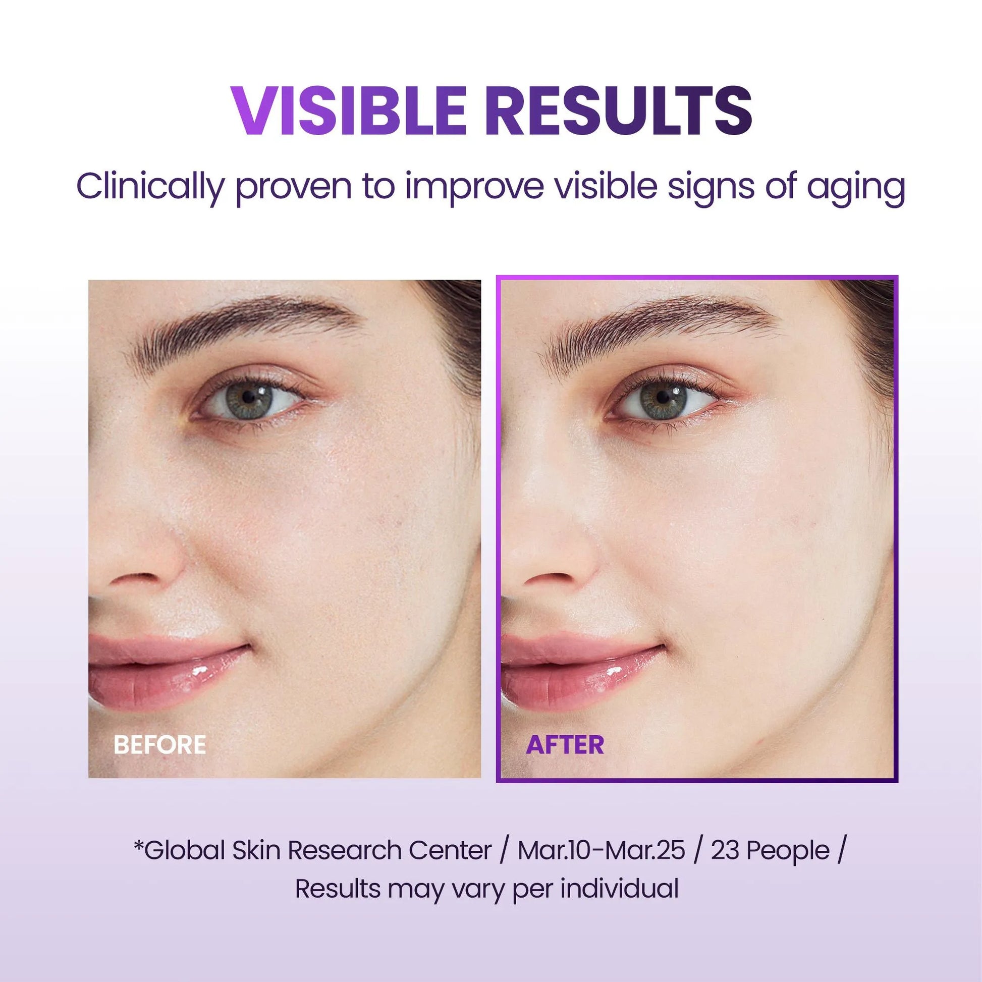 BIOHEAL BOH Probioderm 3D Lifting Cream Mask Before and after comparison of facial skin with text about visible results and clinical provenance