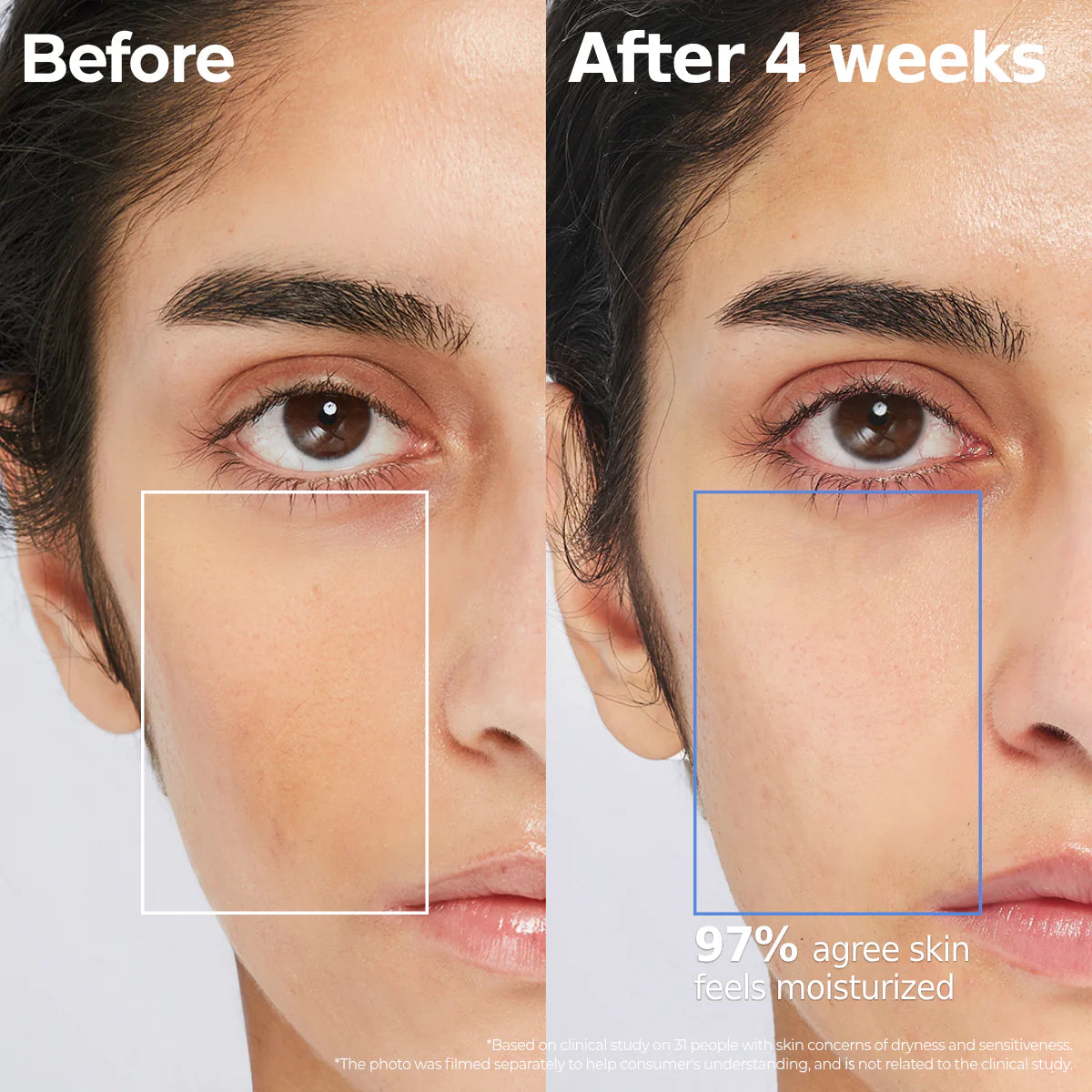 AESTURA Atobarrier 365 Hydro Essence Before and after comparison of skin texture with text indicating improvement and moisture levels after 4 weeks of use