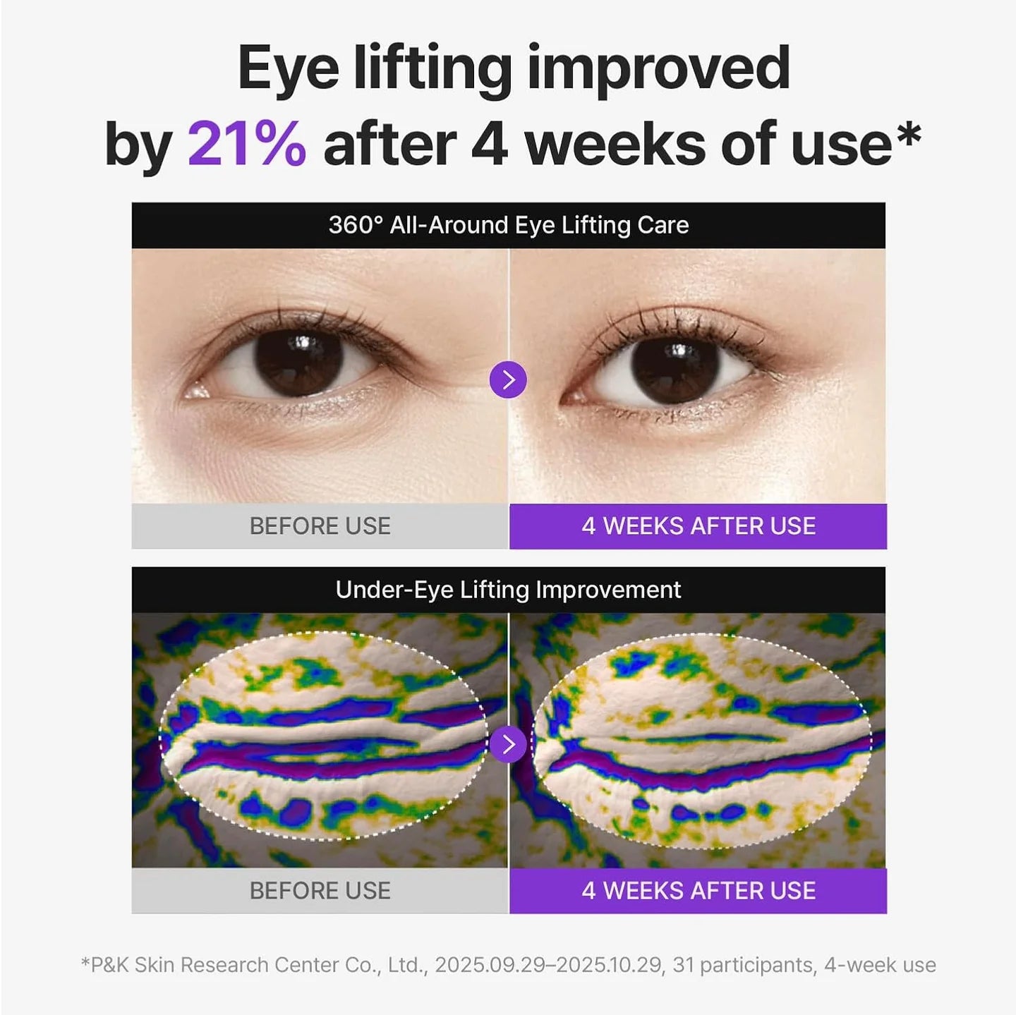 Centellian24 360° Shot PDRN Lifting Eye Cream 30ml