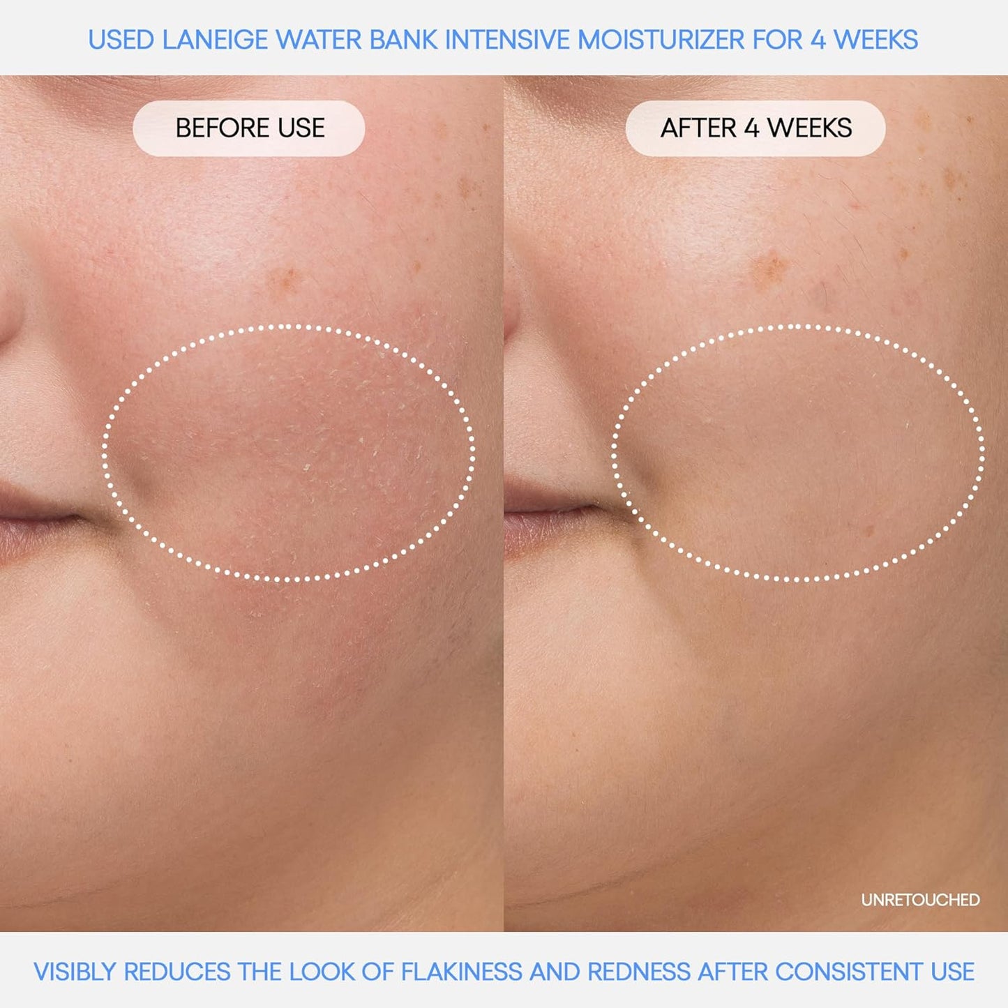 Before and after comparison of Laneige Water Bank Intensive Moisturizer on skin after 4 weeks of use