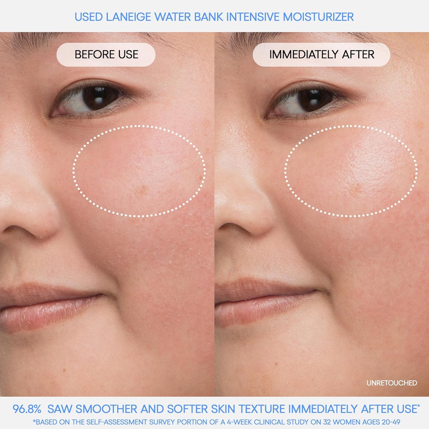 Before and after comparison of Laneige Water Bank Intensive Moisturizer on a person's face immediately after use