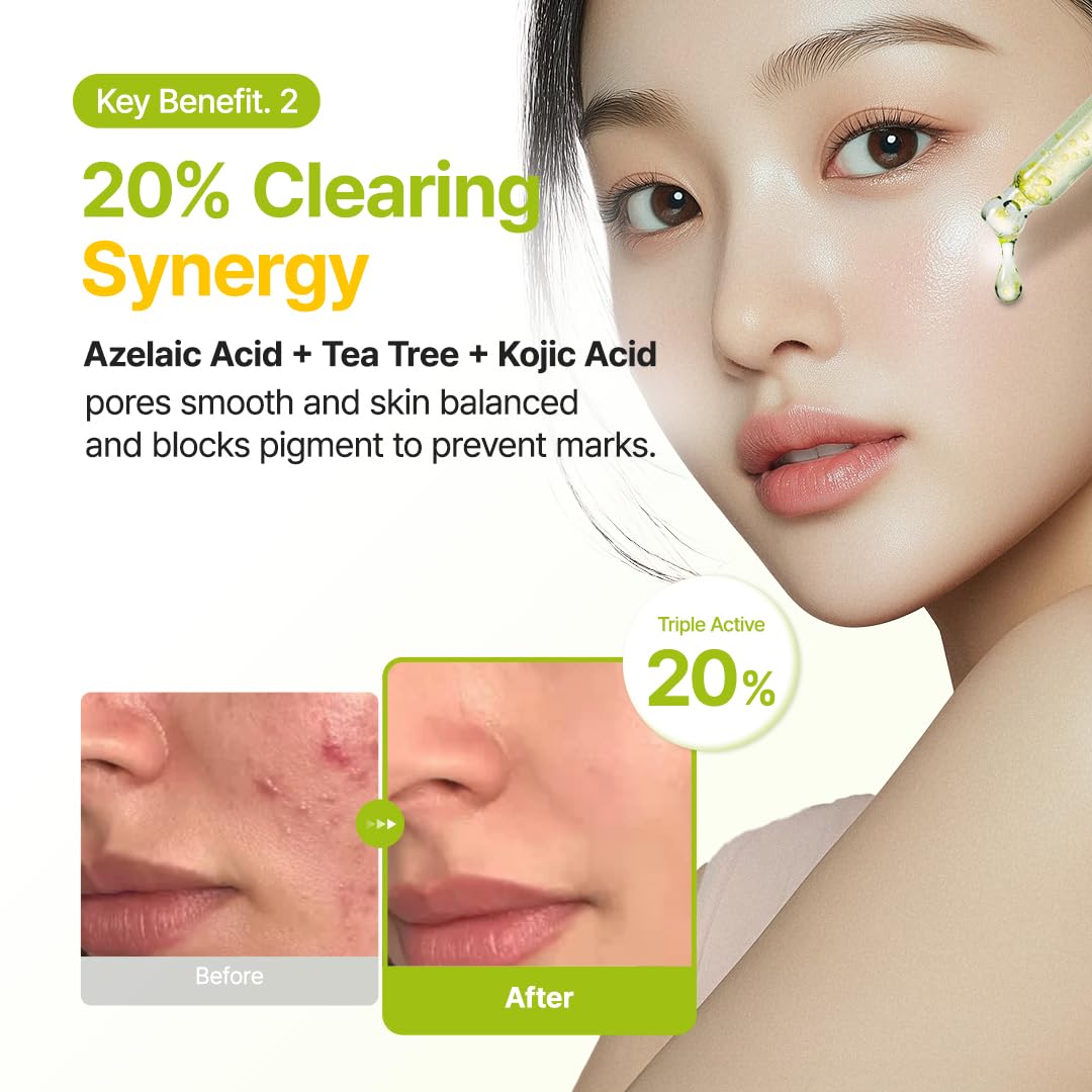 Purito Azelaic Acid 10 Kojic Tea Tree Serum 30ml