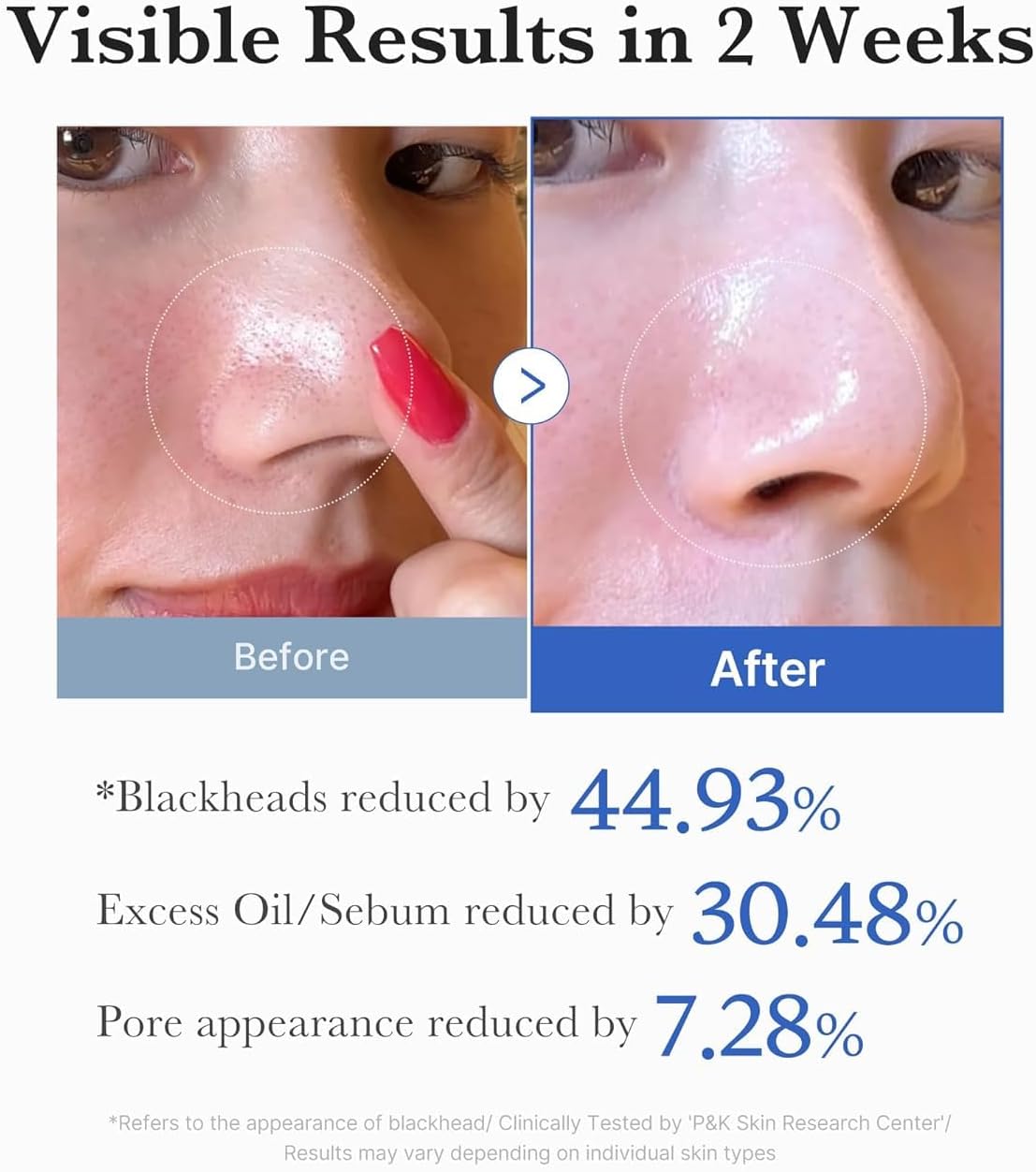 medicube Zero Pore Pad 2.0 (70 Pads) 155g